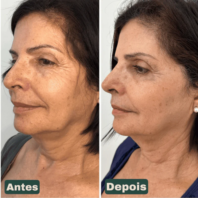 Imagem do produto 4